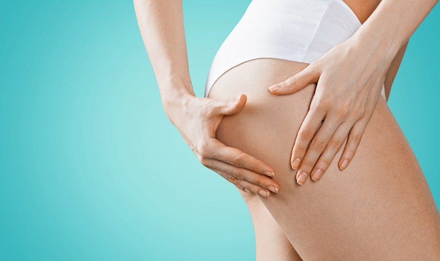 Reduce cellulite with an anti-cellulite diet!