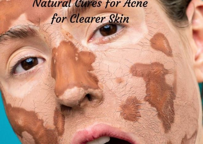 Natural Cures for Acne for a Clearer Complexion