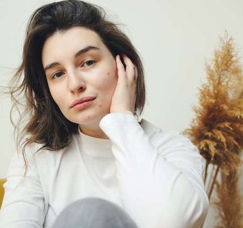 Oily Skin Remedies You Want to Normalize and Better Hydrate Suffering Skin