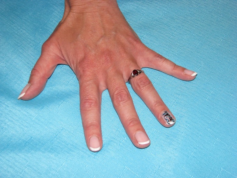 DIY Moisturizing Nail Soak Strengthens Winter Nails