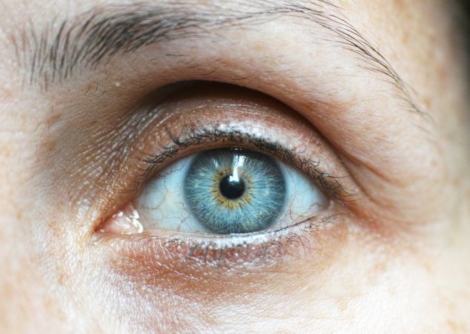 How to Open Up Eyes Despite Short Lashes!