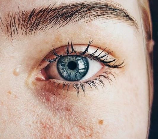 Is Your Skin Breaking Out Without Knowing Why?